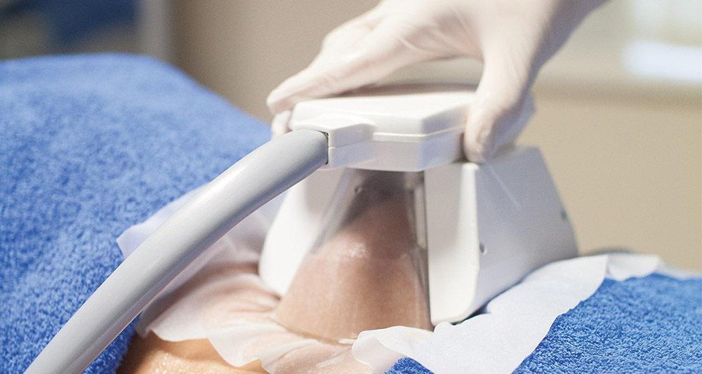How Fat Freezing and HIFU Work Together? 2 Multiple Areas in One Session HIFU and Fat Freezing Hertford