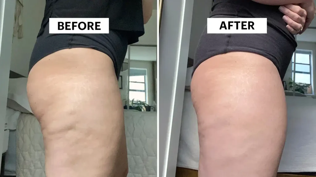Sculpting Your Bum: Can Toning Exercises Really Reduce Cellulite? 1 Do Toning Exercise Hertford Really Tackle Cellulite?