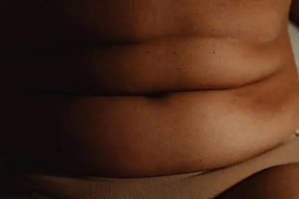The Hidden Connection: How Stress Shapes Your Fitness and Body Composition 3 image of what stress can do on the stomach area and how Lipo 360 Hertford can help to change your body shape.